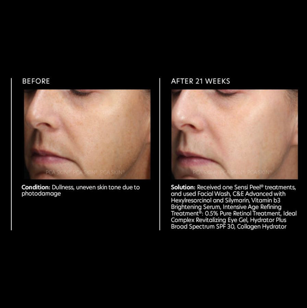 Vitamin b3 Brightening Serum 1oz - Reverie Salon