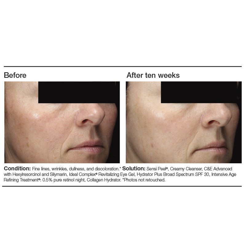 PCA SKIN C&E Advanced with Hexylresorcinol and Silymarin - Reverie Salon