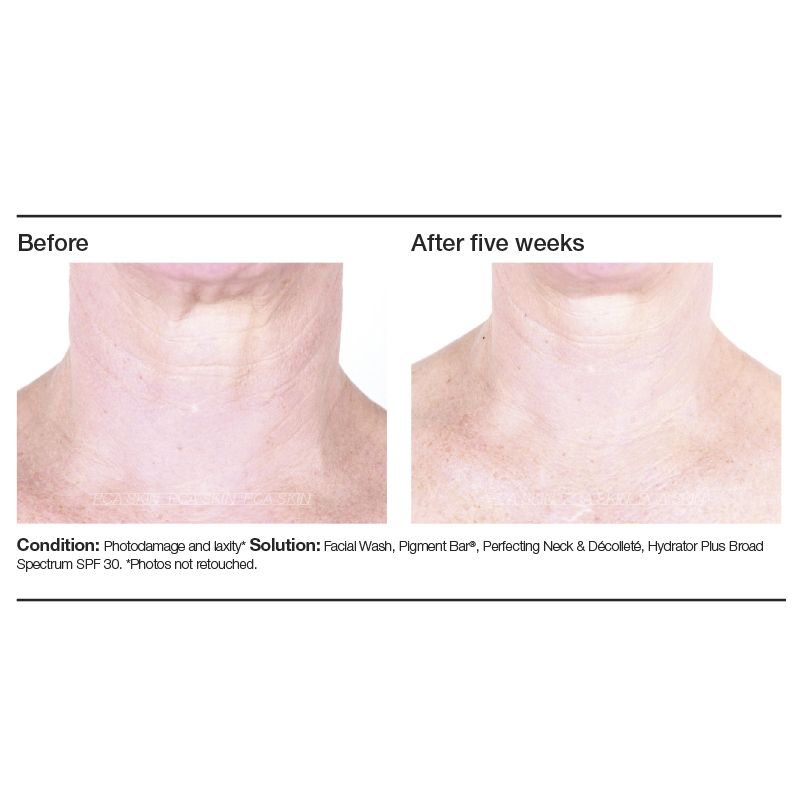 PCA SKIN Perfecting Neck & Décolleté - Reverie Salon
